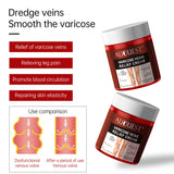 Venous Cream Leg Blood Vessels Bulge Glue Small